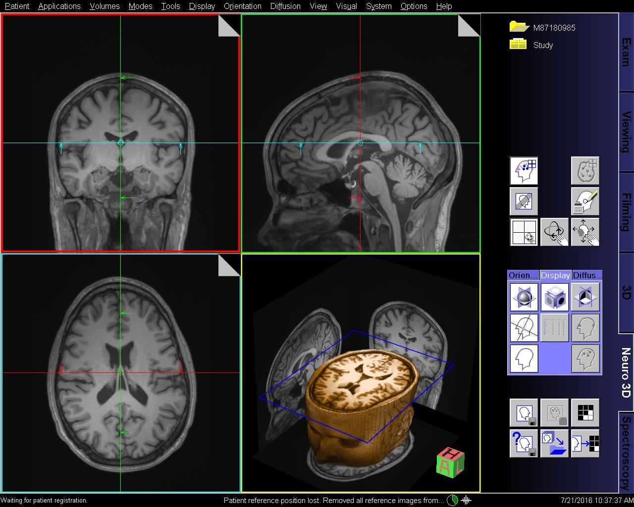 MRI não