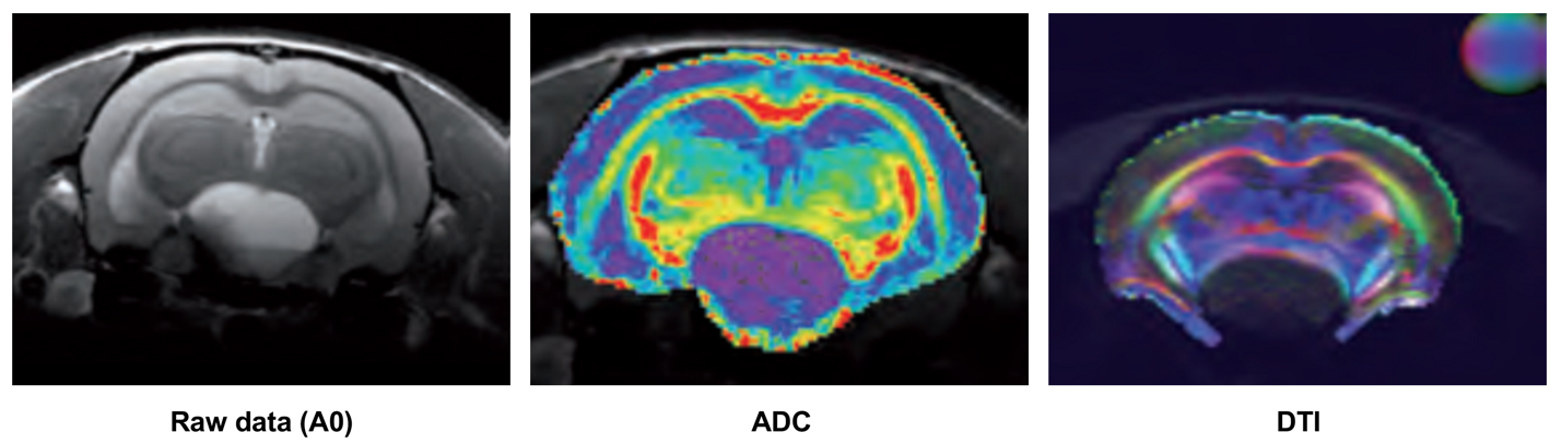 Brain scans