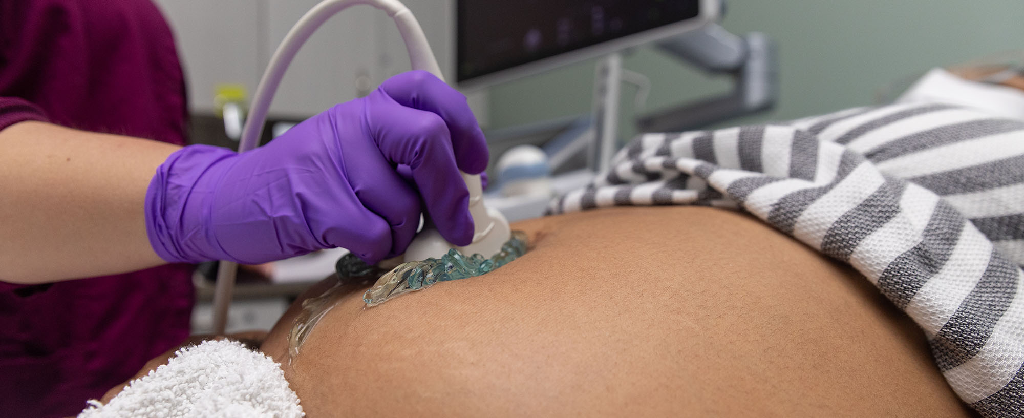A pregnant person getting an ultrasound